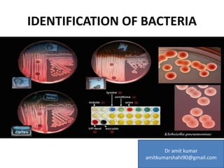 IDENTIFICATION OF BACTERIA
Dr amit kumar
amitkumarshahi90@gmail.com
 