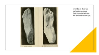 Imersão de diversas
partes de corpo de
Espírito materializado
em parafina líquida. [5]
 