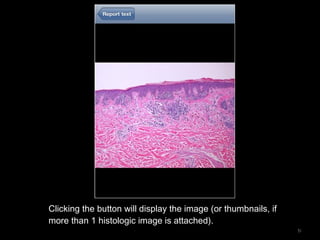 iDermpath, an iPhone app for dermatopathology