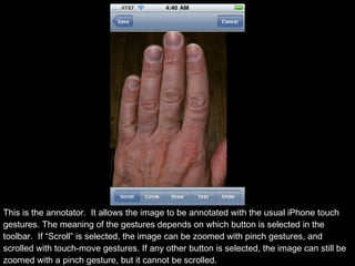 This is the annotator.  It allows the image to be annotated with the usual iPhone touch gestures. The meaning of the gestu...