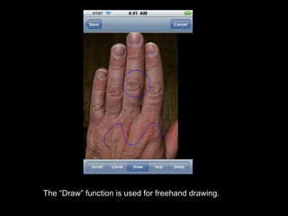 The “Draw” function is used for freehand drawing. 