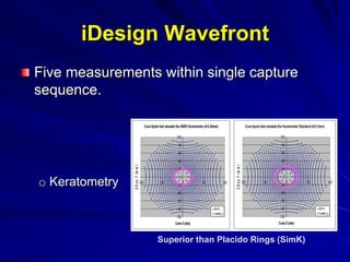Five measurements within single capture
sequence.
o Wavefront aberrometry
o Auto-refraction
o Topography
o Pupillometry
o Keratometry
iDesign Wavefront
Superior than Placido Rings (SimK)
 