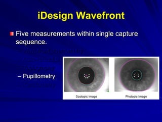 Five measurements within single capture
sequence.
– Wavefront aberrometry
– Auto-refraction
– Topography
– Pupillometry
– Keratometry
iDesign Wavefront
Five measurements within single capture
sequence.
– Wavefront aberrometry
– Auto-refraction
– Topography
– Pupillometry
– Keratometry
 