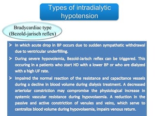 Bradycardiac type
(Bezold-jarisch reflex)
 
