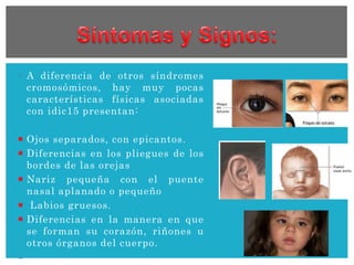 A diferencia de otros síndromes
cromosómicos, hay muy pocas
características físicas asociadas
con idic15 presentan:
 Ojos separados, con epicantos.
 Diferencias en los pliegues de los
bordes de las orejas
 Nariz pequeña con el puente
nasal aplanado o pequeño
 Labios gruesos.
 Diferencias en la manera en que
se forman su corazón, riñones u
otros órganos del cuerpo.

 