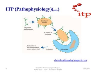 ITP (Pathophysiology)(cont.)
clinicalstudiestoday.blogspot.com
1/25/2015
Idiopathic Thrombocytopenic Purpura
Prof.Dr. Saad...