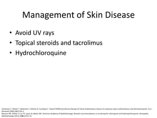 Management of Skin Disease
• Avoid UV rays
• Topical steroids and tacrolimus
• Hydrochloroquine
Yoshimasu T, Ohtani T, Sakamoto T, Oshima A, Furukawa F. Topical FK506 (tacrolimus) therapy for facial erythematous lesions of cutaneous lupus erythematosus and dermatomyositis. Eur J
Dermatol (2002) 12(1):50–2.
Marmor MF, Kellner U, Lai TY, Lyons JS, Mieler WF, American Academy of Ophthalmology. Revised recommendations on screening for chloroquine and hydroxychloroquine retinopathy.
Ophthalmology (2011) 118(2):415–22.
 