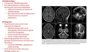 Idiopathic intracranial hypertension (pseudotumor cerebri) | PPT