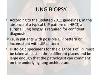 Idiopathic pulmonary fibrosis on lung diseases | PPTX