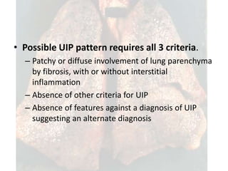 Idiopathic pulmonary fibrosis copy | PPTX