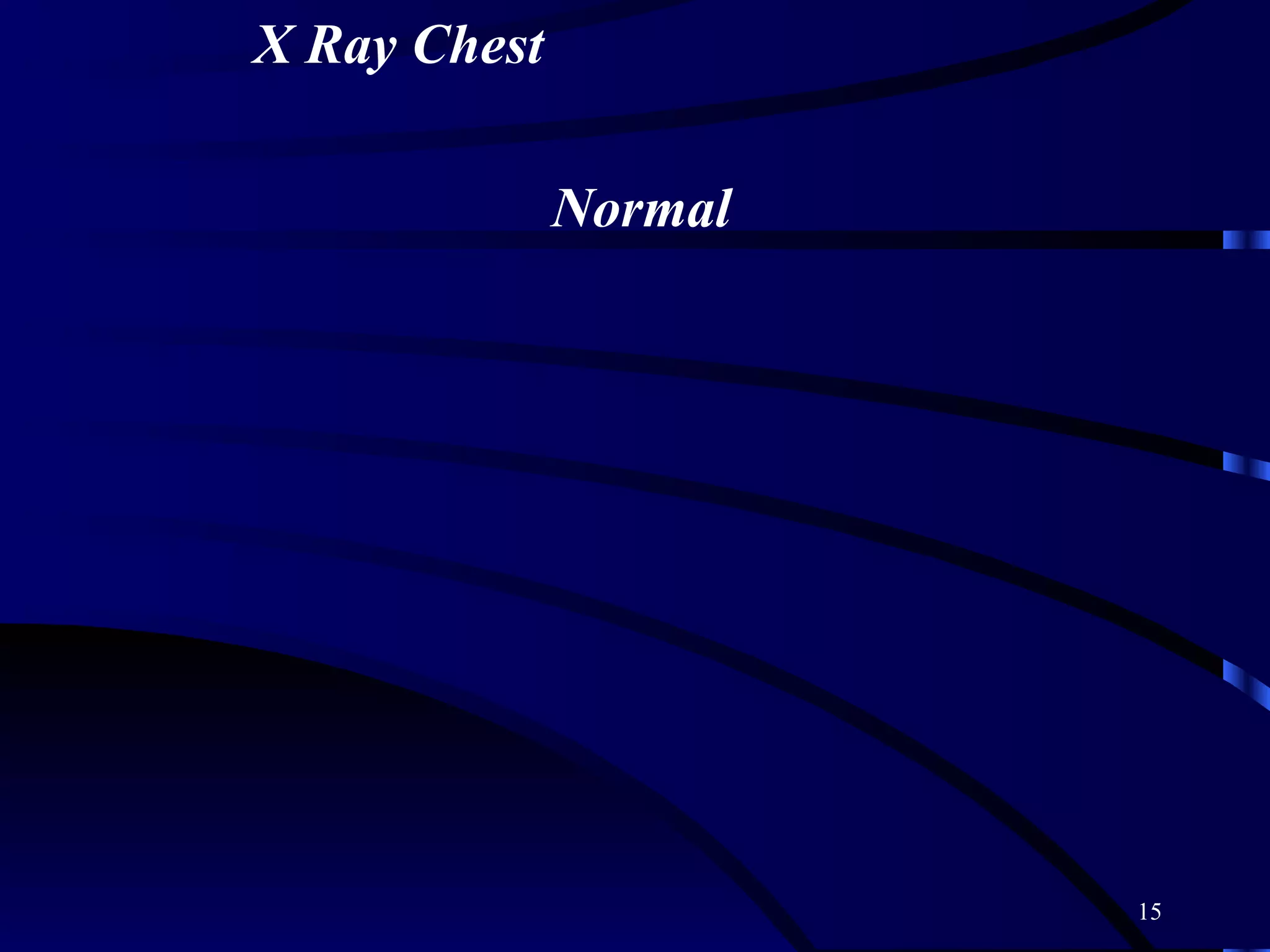 X Ray Chest Normal 