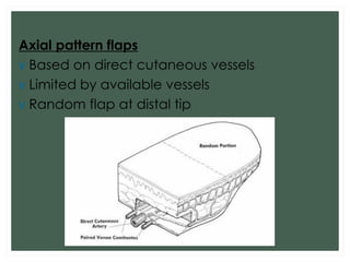 Random Pattern Flasps Skin graft and skin flap | PDF