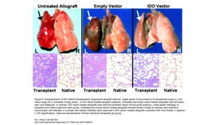 Figure 8. Overexpression of IDO before transplantation suppresses allograft rejection. Upper panel: Gross anatomy of transplanted lungs (L), and
native lungs (R) in untreated, empty vector-, or IDO vector-treated allograft recipients. Untreated and empty vector-treated allografts were shrunken,
hard, and disfigured. In contrast, IDO vector-treated allografts were soft and exhibited nearly normal gross anatomy. Lower panel: Histology of
transplant and native lungs from each group. Untreated and empty vector–treated allografts showed severe (Grade 4) rejection with extensive
mononuclear cell infiltrates. In contrast, few cellular infiltrates were observed in IDO-vector–treated allografts consistent with mild (Grade 1) rejection
(×20 magnification). Data are representative of three individual transplants per group.
Am J Respir Cell Mol Biol,
http://www.atsjournals.org/doi/abs/10.1165/rcmb.2003-0268OC
 