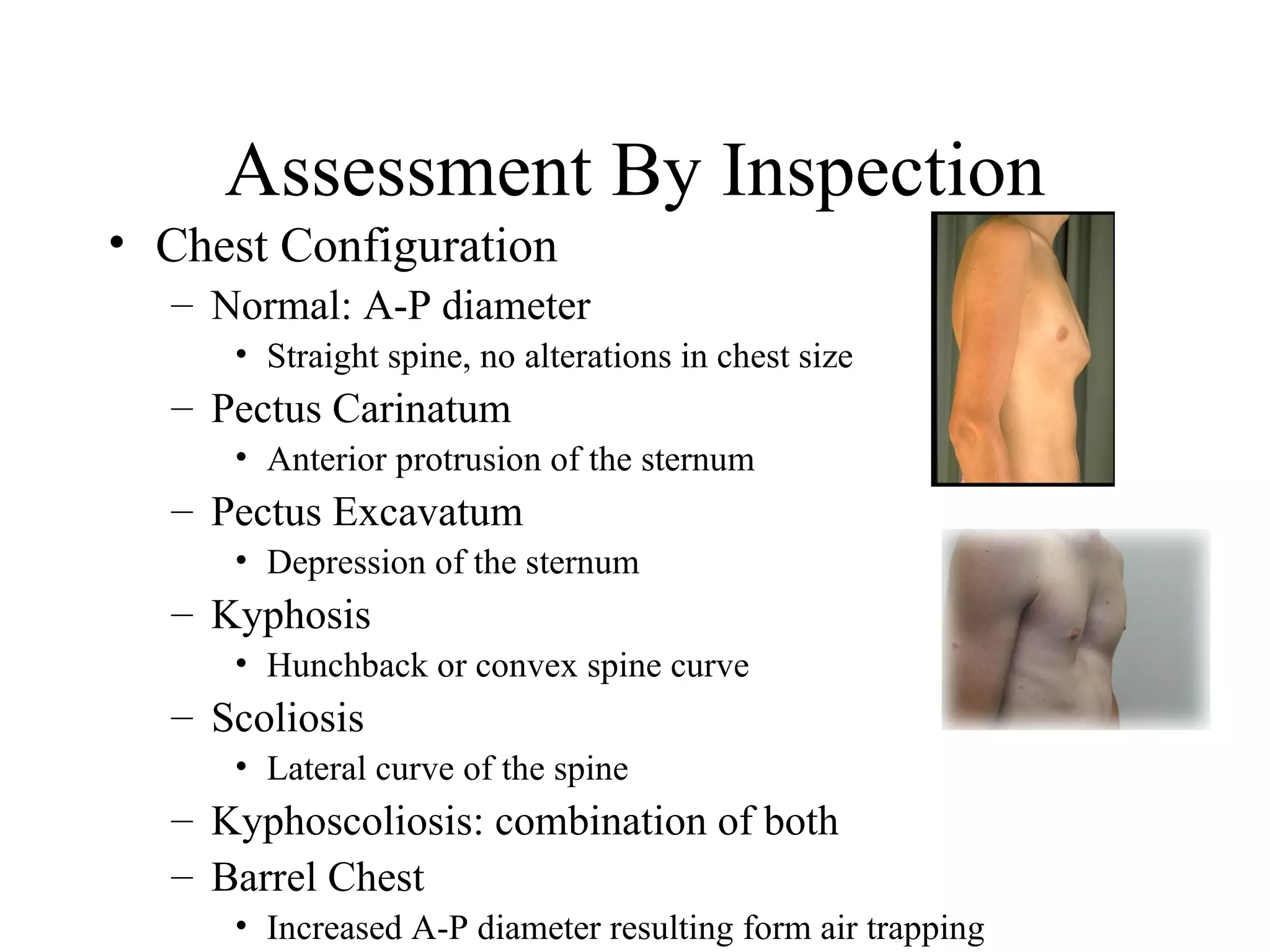 Assessment By Inspection
• Chest Configuration
  – Normal: A-P diameter
     • Straight spine, no alterations in chest size
  – Pectus Carinatum
     • Anterior protrusion of the sternum
  – Pectus Excavatum
     • Depression of the sternum
  – Kyphosis
     • Hunchback or convex spine curve
  – Scoliosis
     • Lateral curve of the spine
  – Kyphoscoliosis: combination of both
  – Barrel Chest
     • Increased A-P diameter resulting form air trapping
 