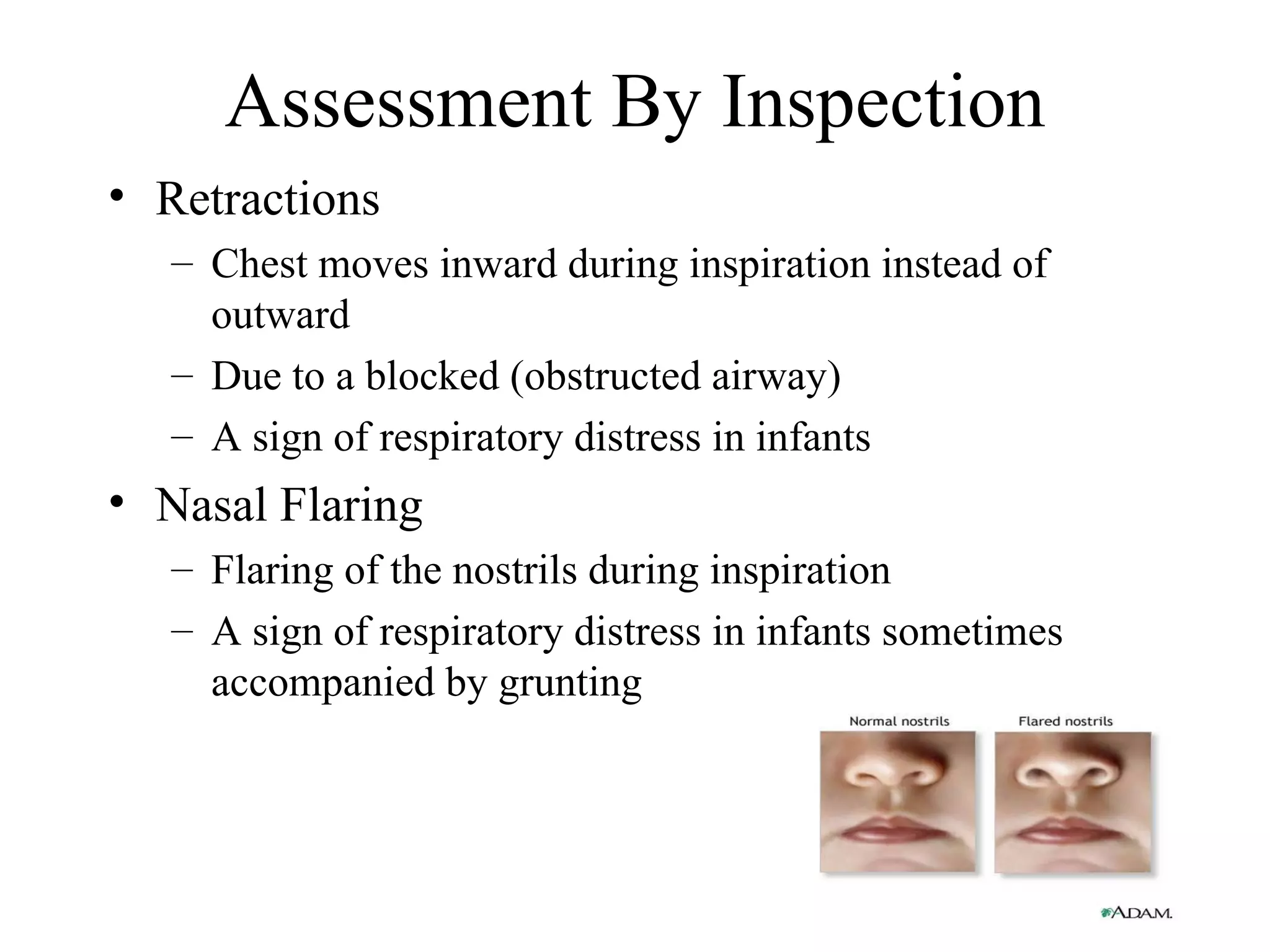 Assessment By Inspection
• Retractions
   – Chest moves inward during inspiration instead of
     outward
   – Due to a blocked (obstructed airway)
   – A sign of respiratory distress in infants
• Nasal Flaring
   – Flaring of the nostrils during inspiration
   – A sign of respiratory distress in infants sometimes
     accompanied by grunting
 