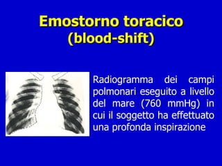 Emostorno toracico (blood-shift) Radiogramma dei campi polmonari eseguito a livello del mare (760 mmHg) in cui il soggetto ha effettuato una profonda inspirazione 