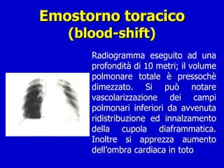 Emostorno toracico (blood-shift) Radiogramma eseguito ad una profondità di 10 metri; il volume polmonare totale è pressochè dimezzato. Si può notare vascolarizzazione dei campi polmonari inferiori da avvenuta ridistribuzione ed innalzamento della cupola diaframmatica. Inoltre si apprezza aumento dell’ombra cardiaca in toto 
