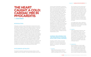 Chapter 6 | CARDIAC MRI IN MYOCARDITIS 67
THE HEART REVEALED RADIOLOGY IN THE DIAGNOSIS AND MANAGEMENT OF CARDIAC CONDITIONS
common cause of myocarditis in Europe and
North America, with Parvovirus B19 and human
herpes virus 6 (HHV 6) being the most fre-
quent in myocardial biopsy. Unfortunately, the
rate of endomyocardial biopsy (EMB), which
is required for definitive diagnosis, is relatively
low, so the true prevalence, aetiology and
outcome for viral myocarditis is poorly under-
stood. The diagnosis is usually suspected in
younger patients without risk factors for cor-
onary artery disease who present with chest
pain and malaise, often following a prodromal
viral illness. Clinical findings are often absent
or non-specific, ECG changes are variable, and
biomarkers such as cardiac troponin do not
differentiate from ischaemic myocardial disease
and may be normal. The European Society of
Cardiology guidelines2
have, none-the-less,
recommended clinical and diagnostic criteria
for the diagnosis of myocarditis. The diagnos-
tic criteria include ECG, troponin, functional or
structural abnormalities on imaging, and tissue
characterisation by CMR.
CARDIAC MRI CRITERIA FOR
THE DIAGNOSIS OF MYOCAR­­-
DITIS (LAKE LOUISE CRITERIA)
The ability of CMR to identify myocardial
inflammation and scar as well as function
has given it a unique role in establishing the
diagnosis of myocarditis3
. These diagnostic
tools include;
1.	 Function
Steady-state free precession (SSFP) cine
imaging is the gold standard to access
cardiac morphology and function. Patients
with myocarditis may show regional wall
motion abnormalities involving the right
ventricle (RV) and the left ventricle (LV) or
more global ventricular dysfunction. When
present, impaired ventricular function has a
worse prognosis. Cine MRI plays an impor-
tant role in the exclusion of other causes
of raised troponin such as hypertrophic
cardiomyopathy. Transient increases in
myocardial thickness are however seen in
myocarditis and reflect myocardial inflam-
mation and increased intra- and extracellu-
lar volume.
Cine images are also useful in identifying
pericardial thickening and effusion, indicat-
ing pericarditis, which is present in 30–50%
of patients with myocarditis.
2.	 Oedema
Tissue characterisation sequences, such
as T2 weighted imaging, with or with-
out fat suppression, visualise myocardial
oedema. A myocardial signal intensity
(SI) to skeletal muscle SI ration of >2.0 is
consistent with myocardial oedema. These
sequences tend to be susceptible to arte-
fact and field inhomogeneity which can
make achieving diagnostic image quality
challenging (Figure 1).
3.	 Hyperaemia
Early post gadolinium contrast images
(EGE) help identify myocardial inflamma-
tion. T1 weighted images early post gado-
linium, showing a global SI enhancement
ratio of myocardium over skeletal muscle
of >4.0 or an absolute myocardial enhance-
ment of >45% is consistent with myocarditis.
THE HEART
CAUGHT A COLD:
CARDIAC MRI IN
MYOCARDITIS
BY CHARLES PEEBLES
INTRODUCTION
Chest pain is a common cause of presentation to medical services with a
wide differential diagnosis. Patients are triaged according to the nature of
the chest pain, clinical findings, ECG, and cardiac biomarkers1
. Those with
ST elevation and positive troponin levels (5–10%) follow an established
clinical pathway for acute myocardial infarction with early revascularisation
strategies involving Primary Percutaneous Coronary Intervention (PPCI)
or thrombolysis (if PPCI is unavailable). At the other end of the spectrum,
many patients are diagnosed with non-cardiac chest pain and are managed
appropriately. A significant proportion of patients (40%) will have troponin
positive chest pain but no ST elevation and the differential lies between
non-ST elevation MI, unstable angina, or other forms of acute myocardial
injury such as myocarditis. Prior to the widespread availability of cardiac
MR (CMR), most of these patients would undergo an invasive coronary
angiogram with 10–15% having normal coronary arteries. The ability of CMR
to identify and characterise myocardial inflammation has revolutionised
the diagnosis of myocarditis. This chapter will illustrate the appearance of
myocarditis with standard and more advanced CMR techniques.
MYOCARDITIS AETIOLOGY
The causes of myocarditis include three main groups; infection, immune
mediated, and toxic myocarditis. Viral infections are thought to be the most
 