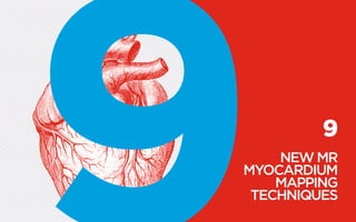 9
NEW MR
­MYOCARDIUM
MAPPING
TECHNIQUES
 
