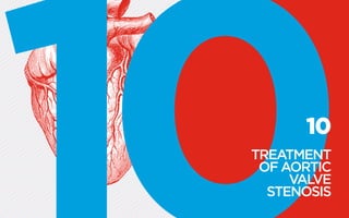10
TREATMENT
OF ­AORTIC
VALVE
­STENOSIS
 