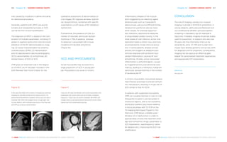 Chapter 16 | SUDDEN CARDIAC DEATH 167166 Chapter 16 | SUDDEN CARDIAC DEATH
THE HEART REVEALED RADIOLOGY IN THE DIAGNOSIS AND MANAGEMENT OF CARDIAC CONDITIONSTHE HEART REVEALED RADIOLOGY IN THE DIAGNOSIS AND MANAGEMENT OF CARDIAC CONDITIONS
trait caused by mutations in genes encoding
for desmosomal proteins.
Generally, patients with ARVC are asymp-
tomatic and unexplained syncope or SCD
can be the first clinical manifestation.
The diagnosis of ARVC is based on the com-
bination of multiple parameters, including (1)
global or regional dysfunction and structural
alteration of the RV demonstrated on imag-
ing; (2) tissue characterisation by endomy-
ocardial biopsy (EMB); (3) repolarisation
and (4) depolarisation electrocardiographic
(ECG) abnormalities; (5) arrhythmias; (6)
familial history of SCD or SCA.
CMR plays an important role in the diagno-
sis of ARVC and it has been included in the
2010 Revised Task Force Criteria, for the
qualitative assessment of abnormalities on
cine images (RV regional akinesia, dyskine-
sia, dyssynchrony), combined with specific
quantitative cut-off values of RV dilatation/
dysfunction.
Furthermore, the presence of LGE is a
marker of inducible ventricular tachyar-
rhythmia in 75% of patients, whereas
its absence is associated with a lower
incidence of inducible arrhythmia
(Figure 10).
SCD AND MYOCARDITIS
Acute myocarditis may account for a
large proportion of SCD in young peo-
ple. Myocarditis is an acute or chronic
inflammatory disease of the myocar-
dium triggered by an infectious agent
(enteroviruses such as Coxsackie B,
adenoviruses, parvovirus B19 and human
herpesvirus type 6) but also by many
other causes, for example opportun-
istic infections, autoimmune response
or drug-related cardiac toxicity. In the
initial phase of viral infection, active viral
replication leads to direct injury and lysis
accompanied by innate immune activa-
tion. In some patients, disease activity
persists and triggers an adaptive auto-
immune response with profound myo-
cardial inflammation, causing HF and
arrhythmias. Acutely, active myocardial
inflammation is arrhythmogenic, caused
by triggered activity and abnormal auto-
maticity, leading to a refractory malignant
ventricular tachyarrhythmia in the context
of severe acute HF.
In chronic myocarditis, myocardial replace-
ment fibrosis promotes re-entrant arrhyth-
mic mechanisms, resulting in a high risk of
SCD similar to that for DCM.
In patients with suspected myocarditis,
CMR can visualise necrosis or scar on LGE
(frequently located in sub-epicardial or
intramural regions, with a non-ischaemic
distribution pattern) and tissue oedema
in the acute phase with T2-STIR or the
T2-mapping technique (Figure 11). Fur-
thermore, CMR allows a reliable quan-
tification of LV dysfunction in order to
appropriately choose the treatment strat-
egy (anti-arrhythmic drugs, pacemaker or
ICD implantation, radiofrequency cathe-
ter ablation etc.), improving the SCD risk
stratification.
Figure 10
A 26-year-old male with a history of dyspnoea, exercise
intolerance and left bundle branch block at ECG. No
abnormal enhancement is present. Short axis (A) and 4
chamber (B) CMR-LGE images show a huge right ven-
tricular dilation with multiple aneurysms in the free wall
and diffuse contrast enhancement.
Figure 11
Case of a 45-year-old female with acute myocarditis who
presented with acute chest pain and mildly increased
troponin-I. Short axis (A) and 4-chamber (B) CMR-LGE
images show a sub-epicardial enhancement at the infero-
lateral wall with endocardial sparing.
A AB B
CONCLUSION
The role of imaging, namely non-invasive
imaging, is pivotal in SCD/SCA prevention; in
young subjects, particularly professional and
non-professional athletes, pre-participation
screening is mandatory (as for example in
Italy) and, if needed, imaging should be widely
used for prevention. In subjects who are over
35 years old, the information that can be
obtained by echo, CT, MR and nuclear tech-
niques have already gained a clinical role, both
for diagnosis and for prognosis; consequently,
imaging can be used as an effective gate-
keeper for personalised treatment approaches
and appropriate ICD implantation.
References
See page 236
 
