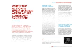 Chapter 17 | IMAGING AFTER ACUTE CORONARY SYNDROME 173
THE HEART REVEALED RADIOLOGY IN THE DIAGNOSIS AND MANAGEMENT OF CARDIAC CONDITIONS
IMAGING IN ACUTE
CORONARY SYNDROME
The basic aim in the treatment of acute myo-
cardial infarction is the revascularisation of the
culprit artery to restore the myocardial blood
flow. Strong evidence exists that early revas-
cularisation is an important factor for a good
clinical outcome and for prevention of ischae-
mic heart failure. Thus, after the – usually
preclinically established – diagnosis of ACS,
patients are directly sent to the cath lab for
revascularisation, and no additional imaging
tests are carried out so as not to lose any time.
However, in up to 30% of patients with myo-
cardial infarction, functional myocardial
recovery is not reached despite good primary
technical success at acute percutaneous cor-
onary intervention (PCI). Possible reasons for
this unfavourable result of acute revasculari-
sation are manifold: the time between coro-
nary artery occlusion and technical successful
revascularisation could have been too long,
which could lead to early myocardial necrosis
in combination with lack of collateral vessels.
Another possible reason could be the persis-
tent occlusion of microvasculature regardless
the restored perfusion within the main epi-
cardial vessels. The reperfusion can also lead
to additional myocardial damage, and in 30%
of the patients the revascularisation is not
complete. Furthermore, in case of multives-
sel disease and multiple coronary lesions, the
usual attempt at the revascularisation of only
the culprit artery might have been insufficient
for full recovery of myocardial function.
The lack of functional recovery after success-
ful revascularisation is known to be a pre-
dicting factor for dismal outcomes like heart
failure and for a high probability of recurring
major cardiovascular events, especially of
re-infarctions. Therefore, the early identifica-
tion of patients with limited or lack of func-
tional recovery is important to improve the
clinical situation, and to prevent complications
and further cardiovascular events.
WHEN THE ACTION IS OVER
– IMAGING AFTER ACUTE
CORONARY SYNDROME
Several studies have been published during
the last decade demonstrating the outstand-
ing potential of cardiac MR derived biomark-
ers in the risk stratification and management
of patients after technically successful treat-
ment of ACS. The aim of using cardiac MR
in this patient population is to assess the
WHEN THE
ACTION IS
OVER: IMAGING
AFTER ACUTE
CORONARY
SYNDROME	
BY CHRISTIAN LOEWE
While cardiovascular imaging by
means of cardiac CT and cardiac MR
plays almost no role in the diagnosis
of acute coronary syndromes (ACS),
the importance of cardiac MR in the
management of patients after treatment
of an ACS is continuously increasing.
The probability of early complications, of delayed or missing recov-
ery and risk of secondary events could be estimated and predicted
by cardiac MR derived biomarkers, underlining the outstanding
potential of cardiac MR in the management of this rather vulner-
able patient population. With further evidence, the guidelines for
patient management after treatment of an ACS could be changed
to include cardiac MR in the near future.
Figure 1
LGE thickness: 57-year-old man. MR performed on day 4 after STEMI (acute
occlusion of LAD). LGE imaging obtained 15 min after administration of 0.2
mmol/kg body weight Gadovist® shows non-transmural subendocardial. Func-
tional recovery of this area is very likely.
 