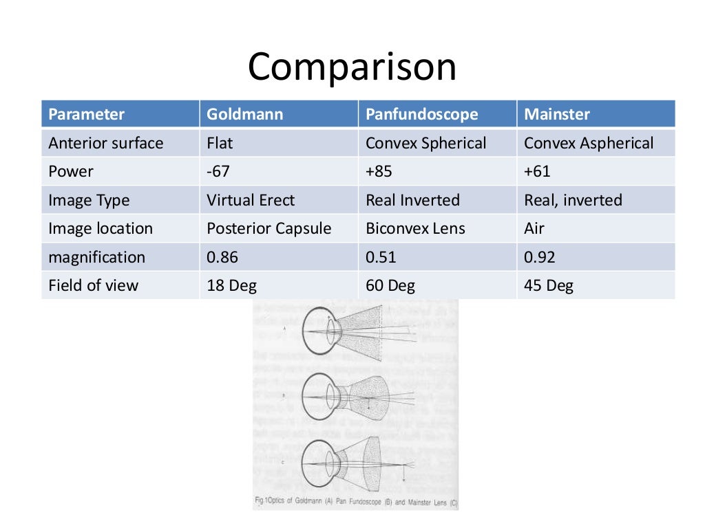 Indirect Ophthalmoscopy and slit lamp biomicroscopy