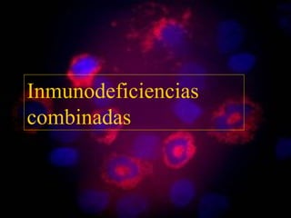Inmunodeficiencias
combinadas
 