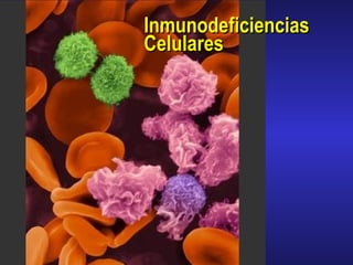 Inmunodeficiencias  Celulares 