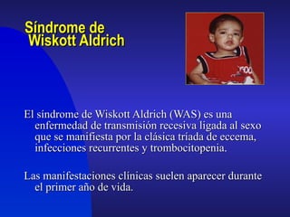 Síndrome de  Wiskott Aldrich ,[object Object],[object Object]