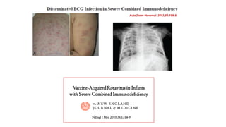 Vaccine-Acquired Rotavirus in Infants
with Severe Combined Immunodeficiency
Acta Derm Venereol. 2012;92:158-9
N Engl J Med 2010;362:314-9
 
