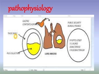 pathophysiology
 