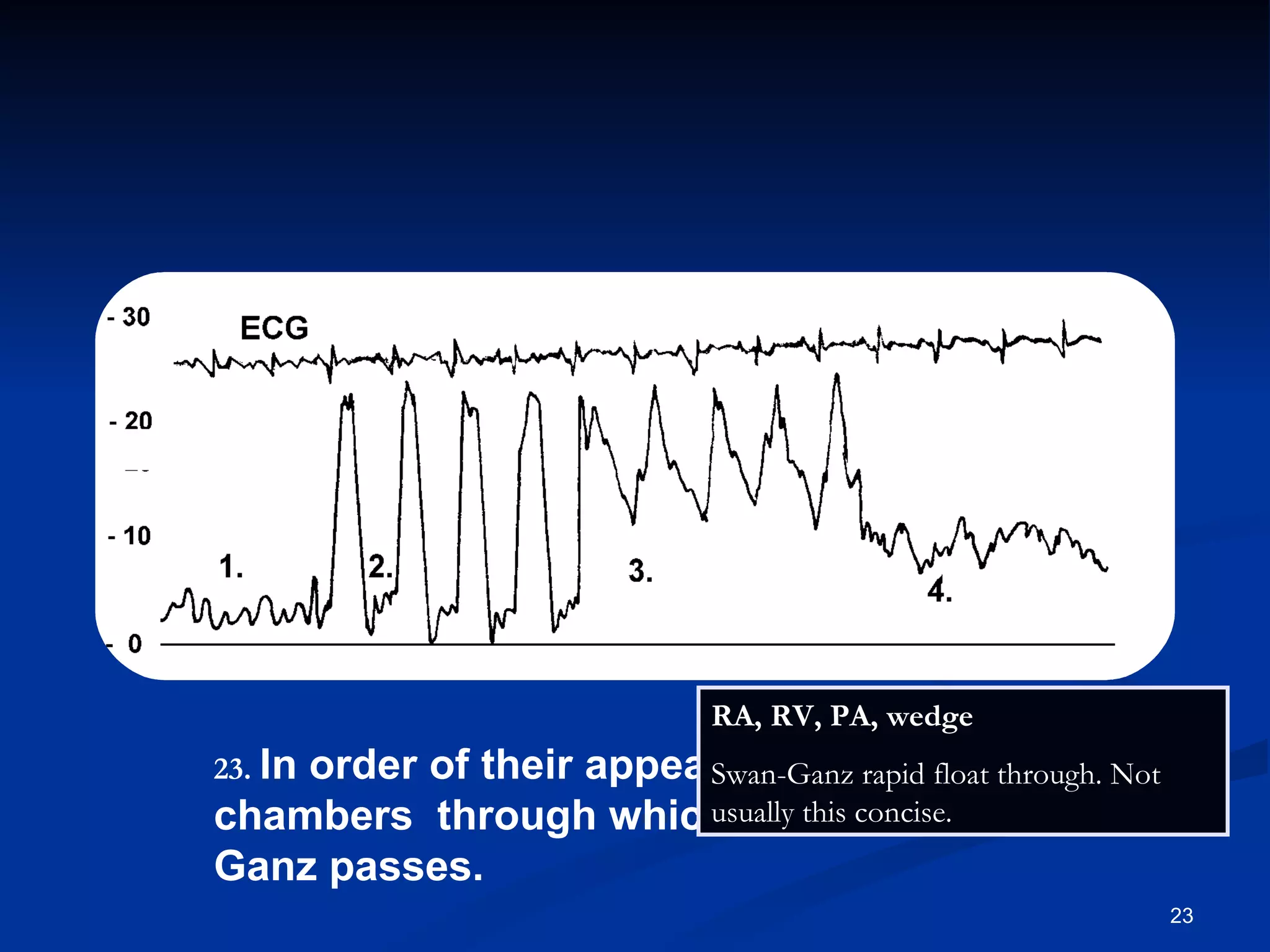 .   In order of their appearance, list the 4 chambers  through which this Swan-Ganz passes. RA, RV, PA, wedge  Swan-Ganz rapid float through. Not usually this concise. 