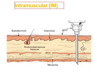 Intramuscular (IM)
 