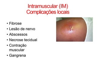 Intramuscular (IM)
Complicações locais
• Fibrose
• Lesão de nervo
• Abscessos
• Necrose tecidual
• Contração
muscular
• Gangrena
 