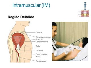 Intramuscular (IM)
Região Deltóide
 