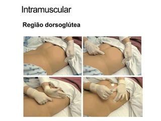 Intramuscular
Região dorsoglútea
 