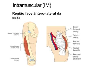 Intramuscular (IM)
Região face ântero-lateral da
coxa
 