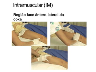 Intramuscular (IM)
Região face ântero-lateral da
coxa
 