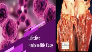 Infective endocarditis 