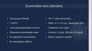 Infective endocarditis 