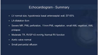 Infective endocarditis 