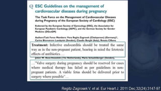 Infective endocarditis 