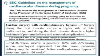 Infective endocarditis 