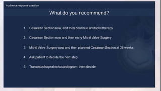 Infective endocarditis 