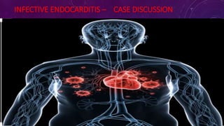INFECTIVE ENDOCARDITIS – CASE DISCUSSION
 