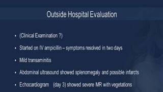 Infective endocarditis 