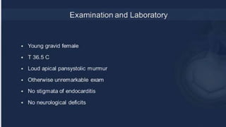 Infective endocarditis 