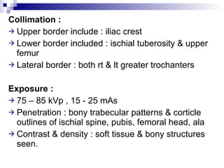Ie 6 Pelvic Girdle | PPT