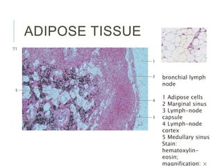 ADIPOSE TISSUE
bronchial lymph
node
1 Adipose cells
2 Marginal sinus
3 Lymph-node
capsule
4 Lymph-node
cortex
5 Medullary sinus
Stain:
hematoxylin-
eosin;
magnification: ×
 